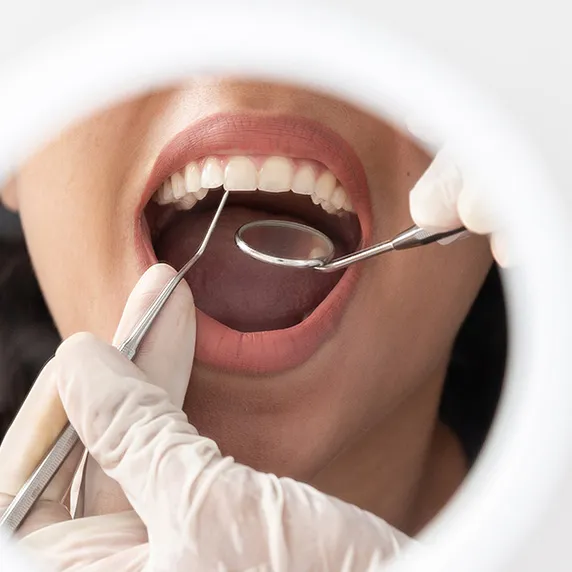 Naujiena! Individualus dantų gydymo planas